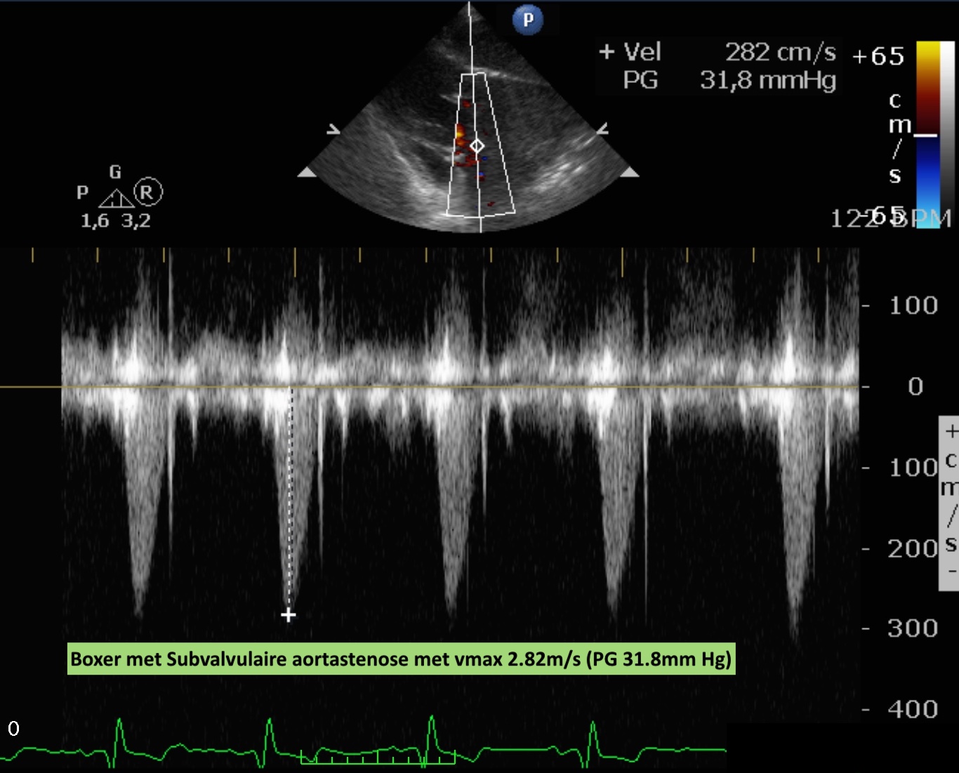 Aortastenose - Dierenarts Jonker